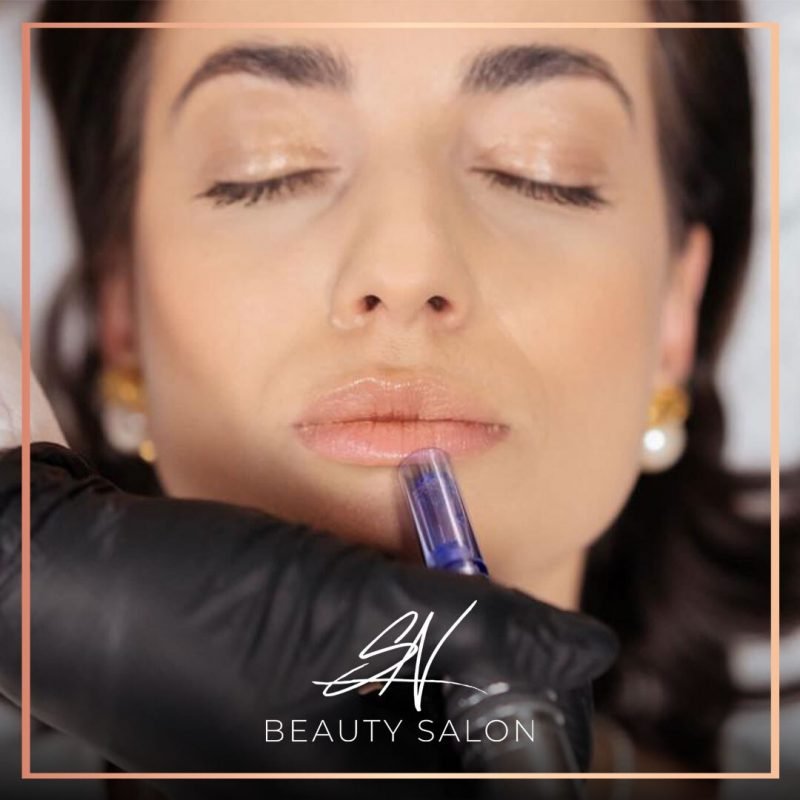 mezoterapia testata pe propria piele